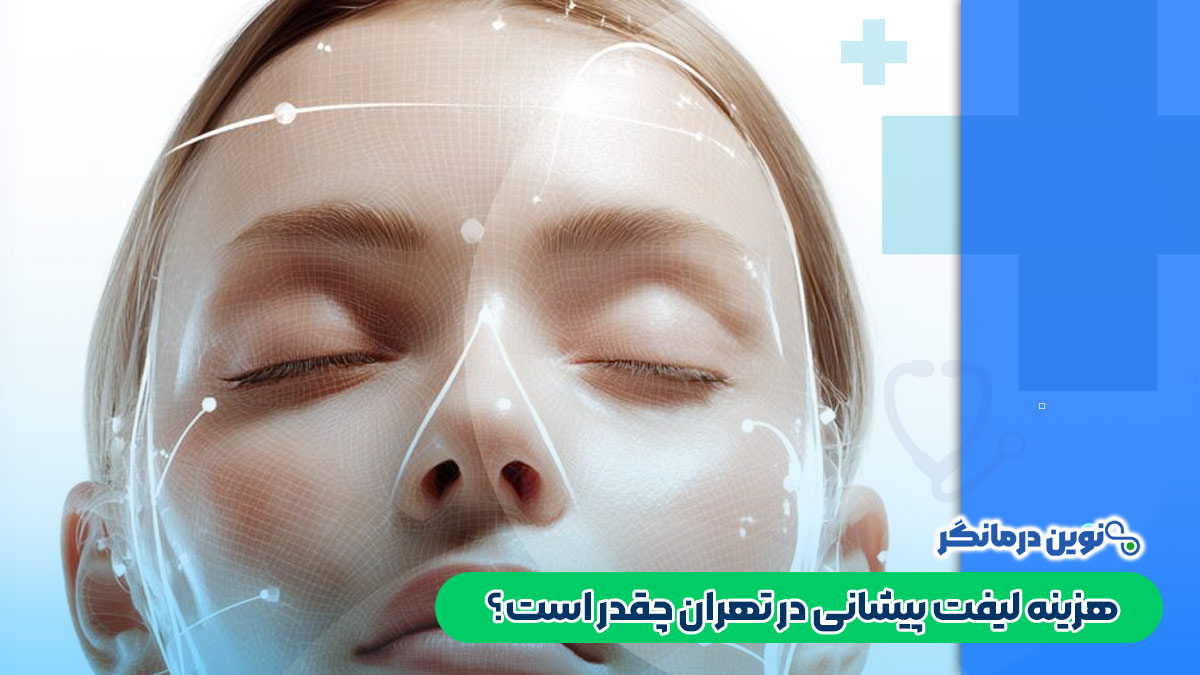 هزینه لیفت پیشانی در تهران چقدر است؟