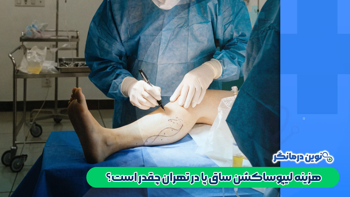 هزینه لیپوساکشن ساق پا در تهران چقدر است؟