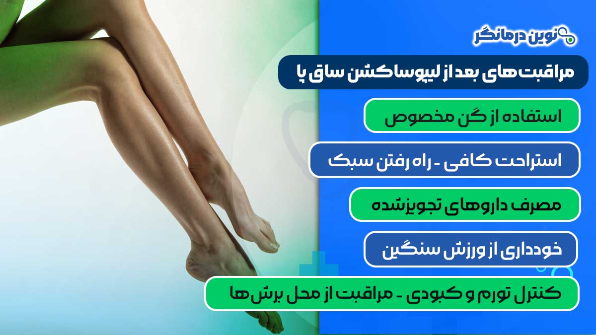 مراقبتهای بعد از لیپوساکشن ساق پا