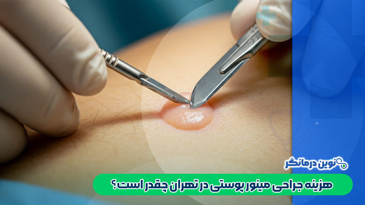 هزینه جراحی مینور پوستی در تهران چقدر است؟