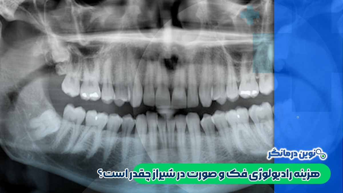 هزینه رادیولوژی فک و صورت در شیراز چقدر است؟