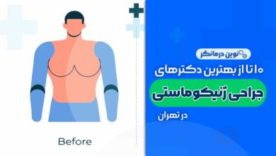 ژنیکوماستی (جراحی کوچک کردن سینه مردان) در تهران