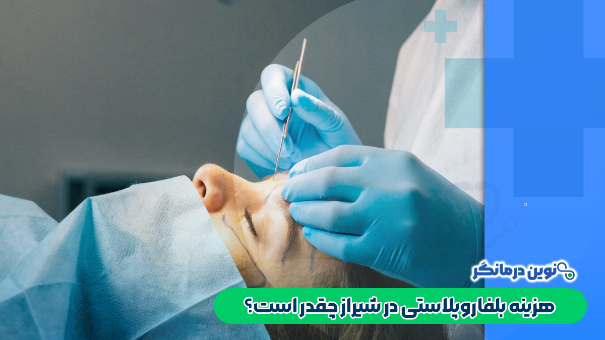 هزینه بلفاروپلاستی در شیراز چقدر است؟