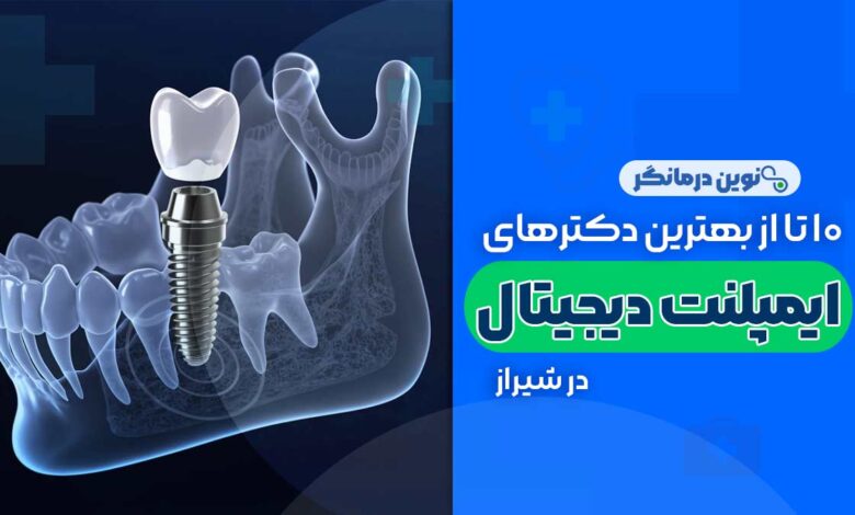 ایمپلنت دیجیتال در شیراز