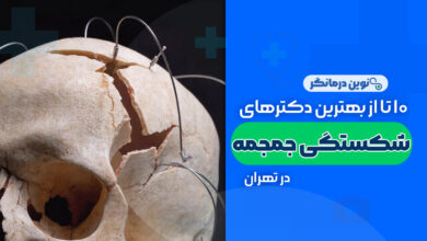 بهترین دکترهای شکستگی جمجمه در تهران
