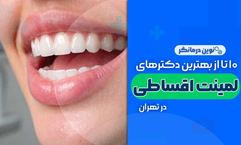 لمینت دندان اقساطی در تهران