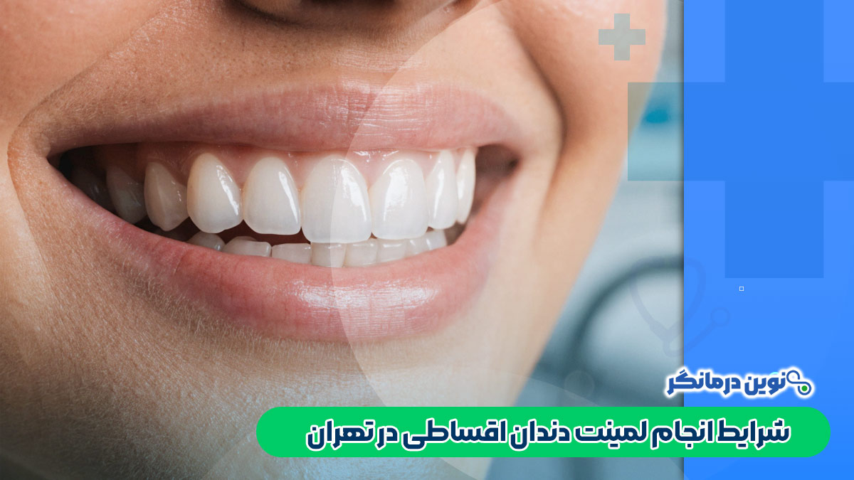 شرایط انجام لمینت دندان اقساطی در تهران