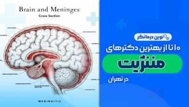 دکتر مننژیت در تهران