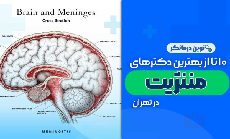 دکتر مننژیت در تهران