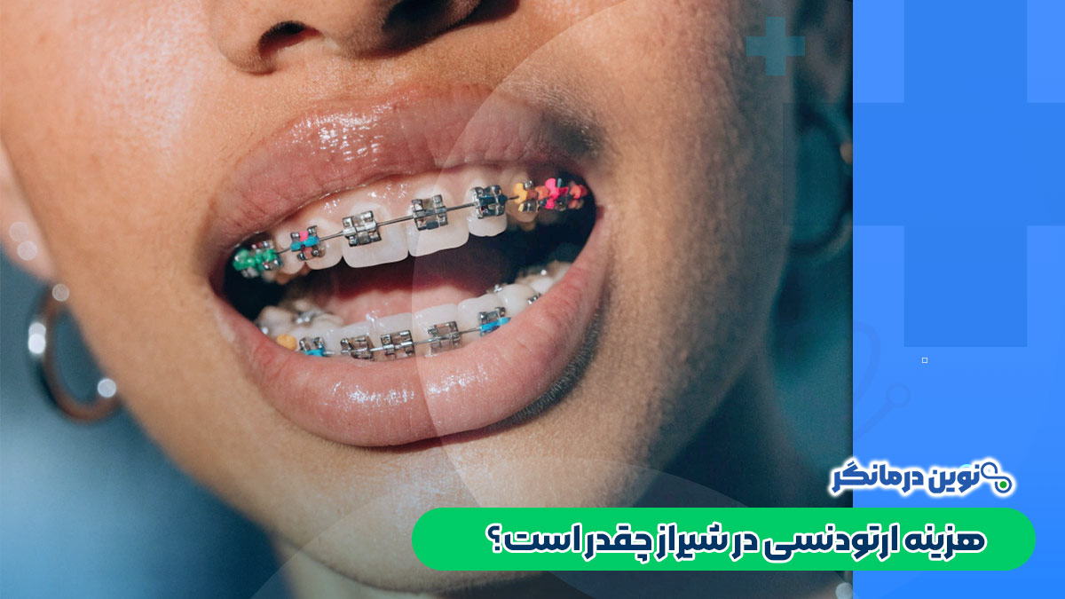 هزینه ارتودنسی در شیراز چقدر است؟