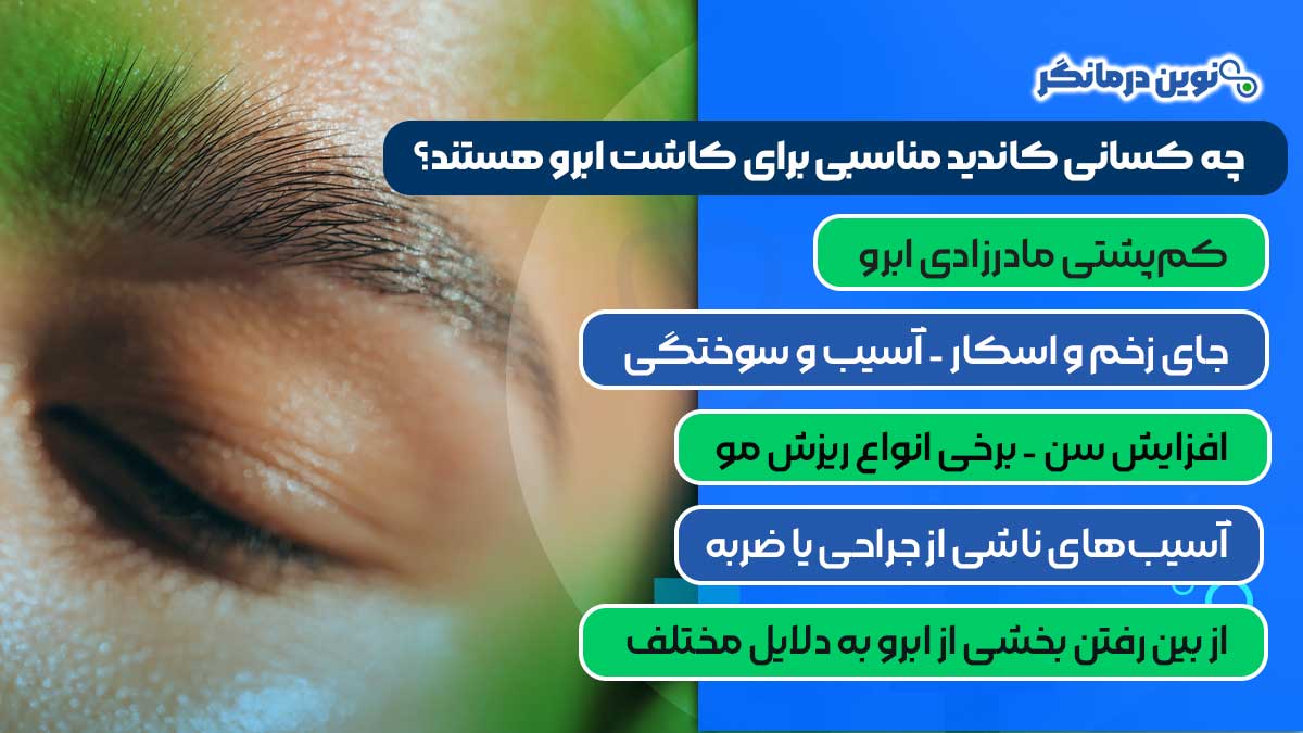 چه کسانی کاندید مناسبی برای کاشت ابرو هستند؟