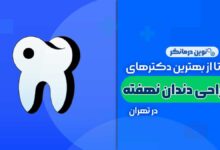جراحی دندان نهفته در تهران