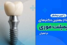 ایمپلنت فوری در تهران