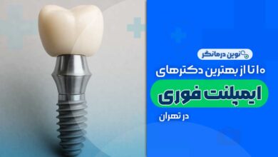 ایمپلنت فوری در تهران